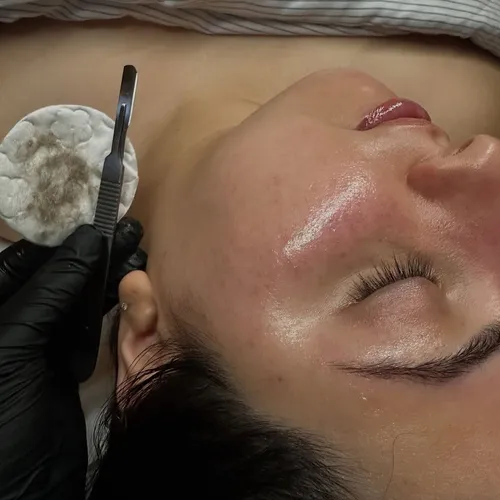 Limpieza Facial + Dermaplaning