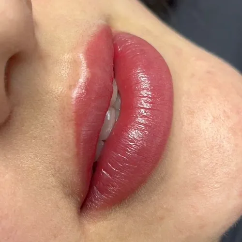 Retoque de Micro Lips