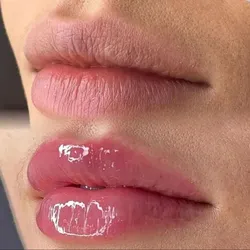 Hidragloss Lips