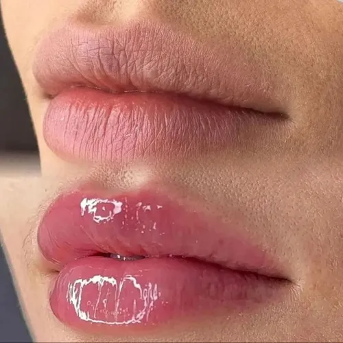 Hidragloss Lips
