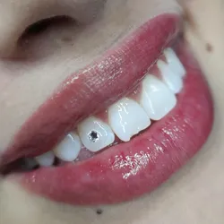Joyería Dental 