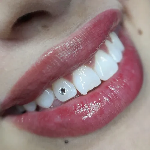 Joyería Dental 