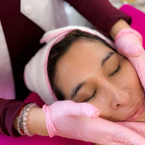Dermapen + tratamiento de ojeras  (EFT 62.000)