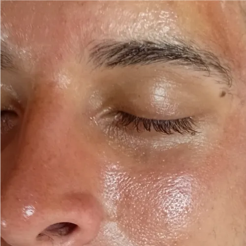Trat. Dermaplaning 🌺