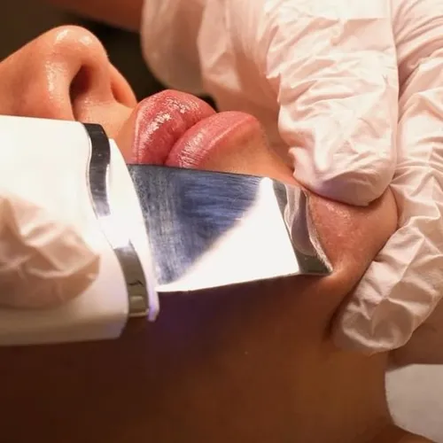 Limpieza facial profunda 