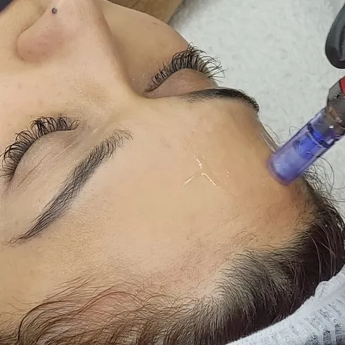 Dermapen