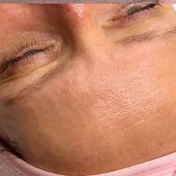 FACIAL BIOMIMÉTICO