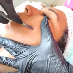 Dermaplaning Efecto piel de Porcelana 