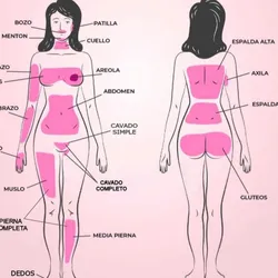 Depilación láser (abdomen)