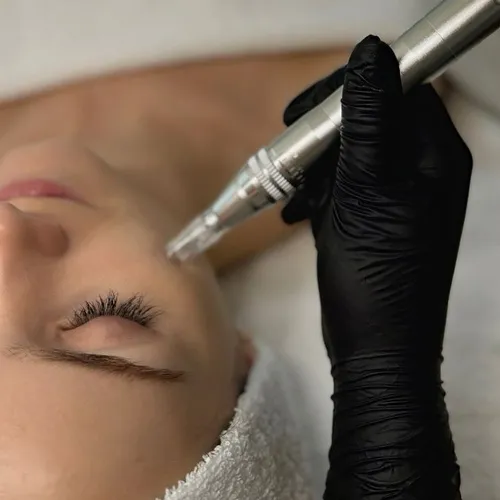Microneedling