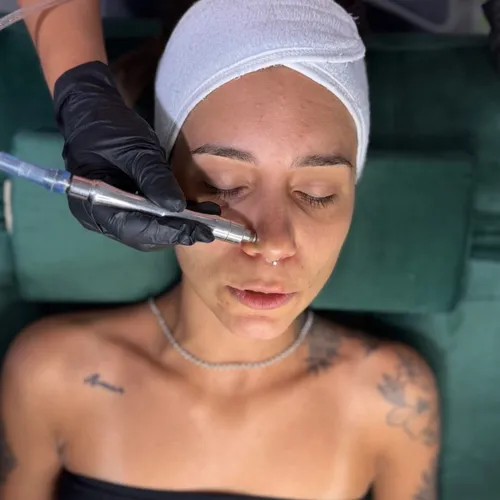 Limpieza facial completa + ADICIONAL