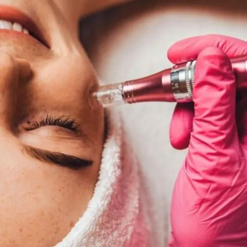 Microneedling
