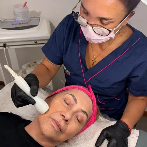 RADIOFRECUENCIA FACIAL