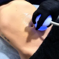 RADIOFRECUENCIA CORPORAL