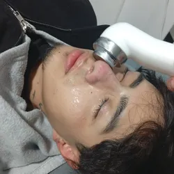Tratamiento post operatorio Rinoplastia /Lifting facial