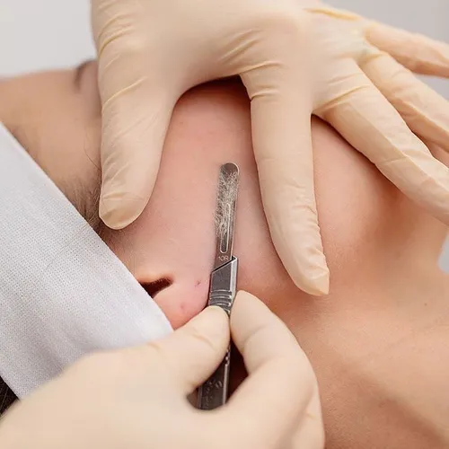 Dermabeauty 