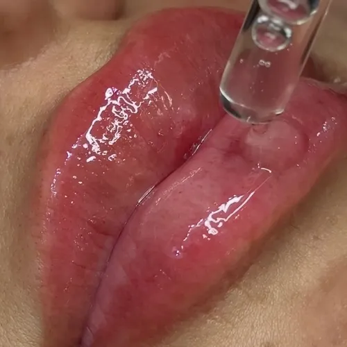 Hydralips