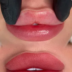 Retoque de labios