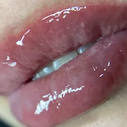 Full face laminado + lifting + Hydra lips
