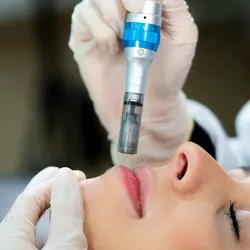 Hidralips (labios)