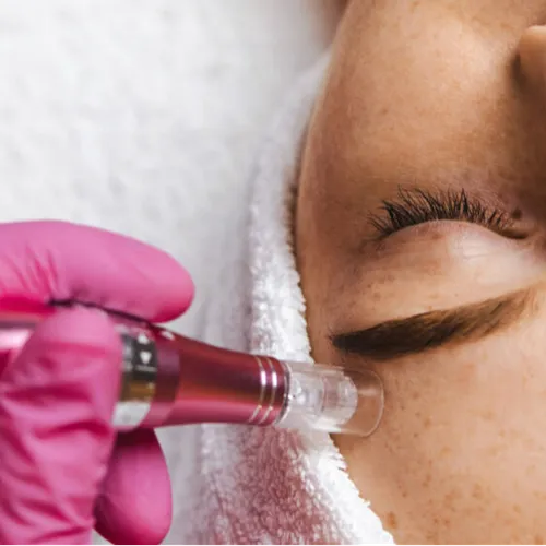  HydraGlow → Microneedling+Ac.Hialurónico (y otros activos)