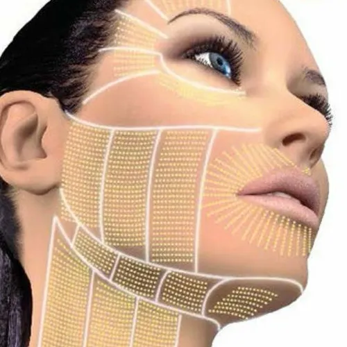 Tensado profundo con HIFU 22D: Rostro