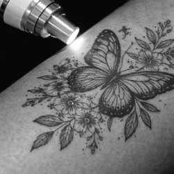 Eliminación de tatuajes (Medianos)