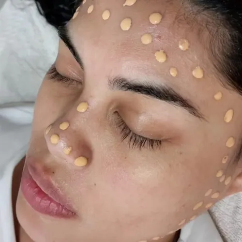 Dermapen + BB Glow