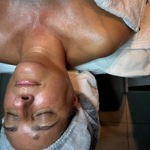 Limpieza facial profunda