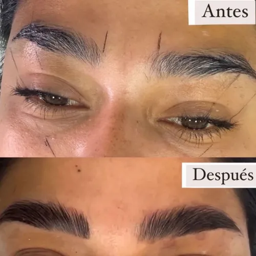 Laminado y Perfilado de Cejas + Botox