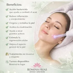 Tratamiento Facial para Acné 