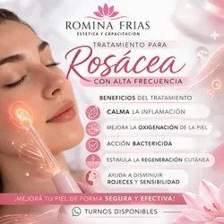 Tratamiento para Rosacea