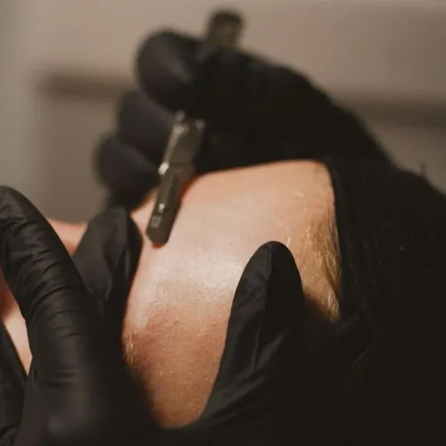 Higiene Profunda+ Dermaplaning