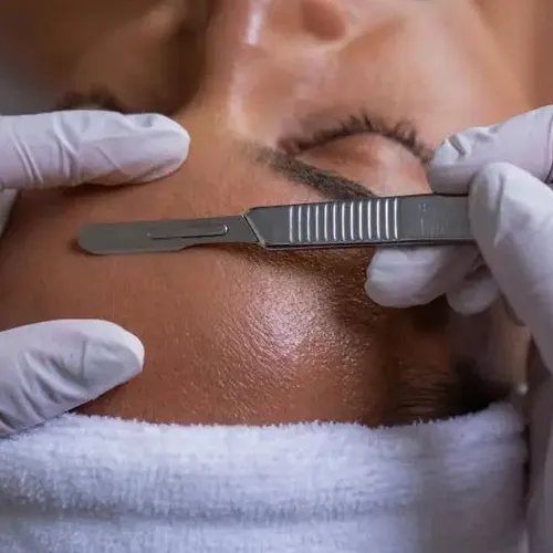 Dermaplaning