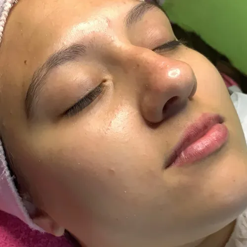 Limpieza facial profunda y aparatologia 