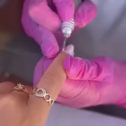 Reparación una uña 