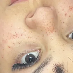 Pecas hiperrealistas