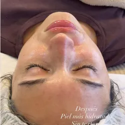 Facial premium + PEELING 