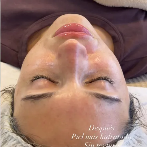Facial premium + PEELING 