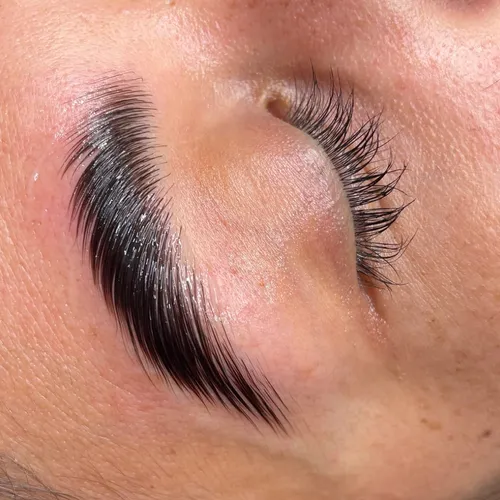 Laminado con nutrición y botox