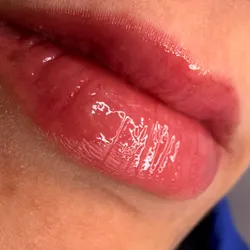 Retoque Micro Labial (hasta los 45 dias)