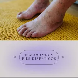 Tratamiento para diabéticos