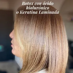 Botox con Ácido Hialurónico 
