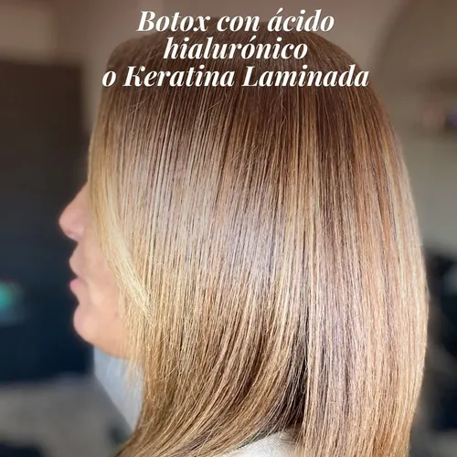 Botox con Ácido Hialurónico 