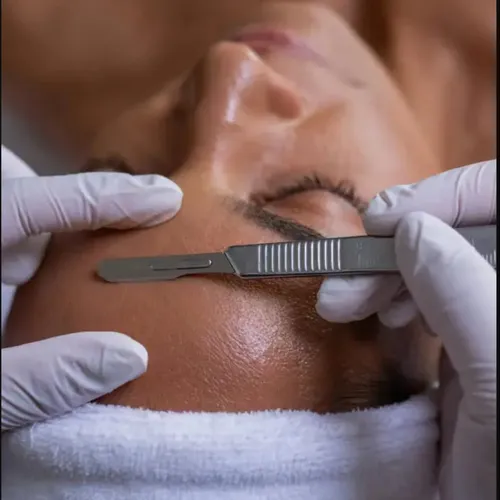 Dermaplaning 