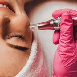 Microneedling - Rejuvenecimiento