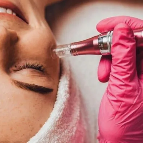 Microneedling - Rejuvenecimiento