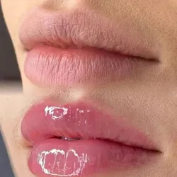 HIDRA-LIPS (Hidratación intensiva de labios)