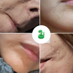 PEELING DESCAMATIVO || Yellow Peel