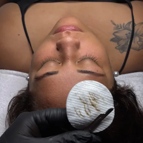 Limpieza Facial Profunda + Dermaplaning